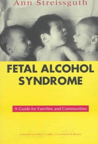 Cover image for Fetal alcohol syndrome : 